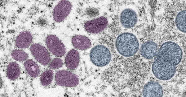 12_aug_2022_monkeypox_virion_(colorized)_-_cdc.jpg