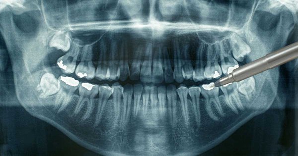 dental-xrays.jpg