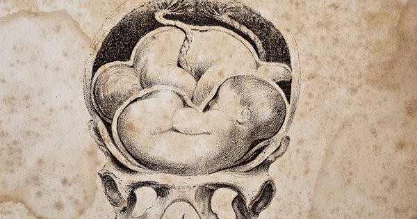 pts_placenta.jpg